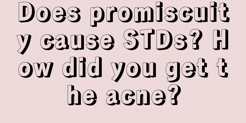 Does promiscuity cause STDs? How did you get the acne?