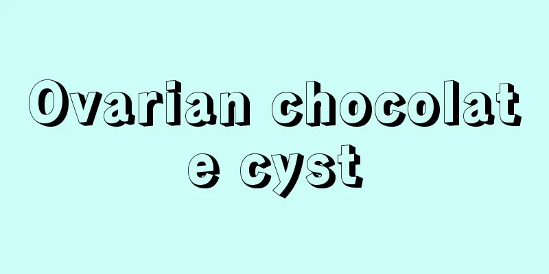 Ovarian chocolate cyst